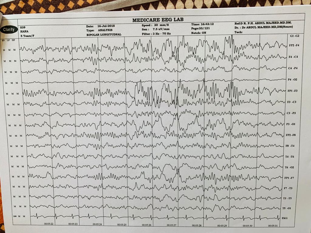 Patient Story